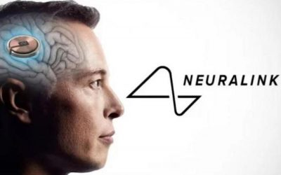 Todo lo que usted debe saber sobre Neuralink y su primer implante cerebral humano