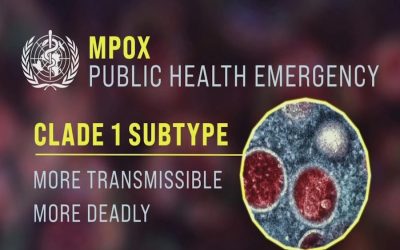 EE.UU. se prepara para posible llegada de cepa más severa de MPOX